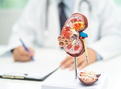 Nierenmodell mit Arzt im Hintergrund 