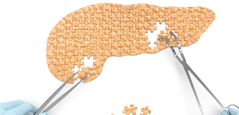 Darstellung des Pankreas als Puzzle