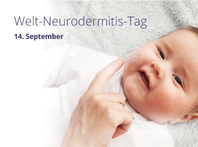 Baby wird eingecremt – Welt-Neurodermitis-Tag am 14. September