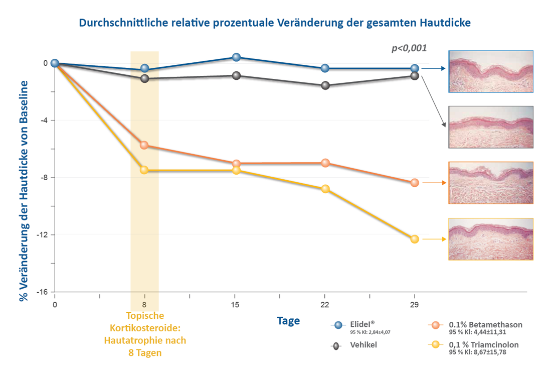 Abbildung zur Veränderung der Hautdicke unter Elidel und TCS