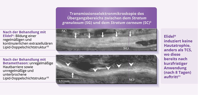 Bild, das eine Transmissionselektronmikroskopie des Übergangsbereichs zwischen dem SG und dem SC3 zeigt10 